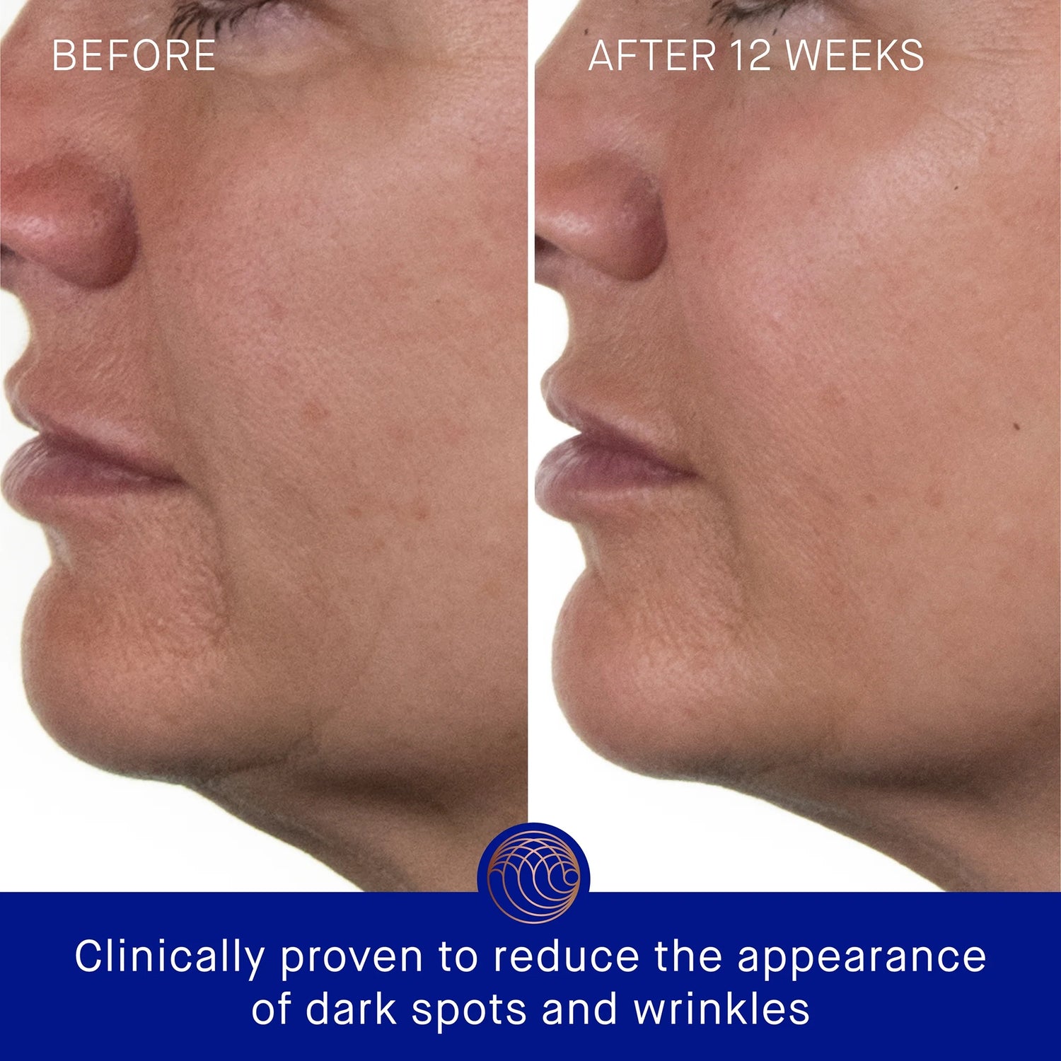 Augustinus Bader The Rich Cream (1.7 Fl. Oz. / 50mL) *NEW IN BOX / SEALED